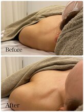 イリゼ(iriser)/デコルテ肩首マッサージ