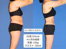 アンシャンテ 神戸元町店(Enchante)/痩身ダイエット　神戸元町三ノ宮