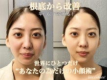 リノコロレ(ino.colore')