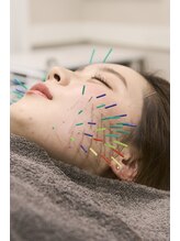 ヴィーライン 上大岡(VeLine)/最上級の形状記憶美容鍼