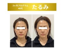 スリー治療院 伏見桃山(THREE治療院)/【たるみ改善】小顔矯正