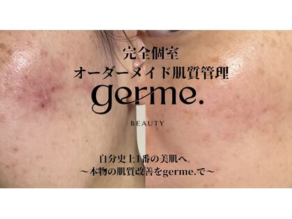 ジェルム(germe.)の写真