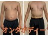 【本気痩せ】ダイエットコース体験!1か所集中施術90分¥25,000→¥6,900