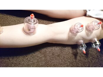 プライベートサロン　ファブール/【カッピング】