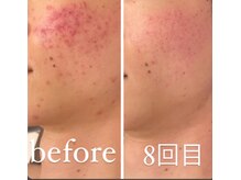 ジーニー(Genie)/望むお肌のオーダーしてますか？