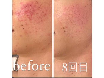 ジーニー(Genie)/望むお肌のオーダーしてますか？