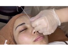 ステライチマルサン(stella.103)/骨格に合わせて似合わせ眉