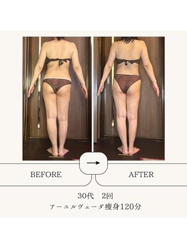 アーユルヴェーダアンドアロマエステ アユス(AYUS)/【40代】痩身