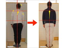 リファイン(Refine)/左右の肩の高さや軸が整う