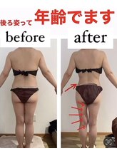 サロン ド モナ(salon de mona)/【後ろ姿ビフォーアフター】痩身