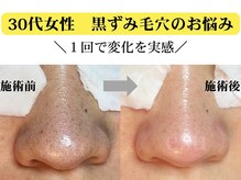 エス(esu)の雰囲気(機械を使わないオールハンド技術!一度での変化にお客様は感動◎)
