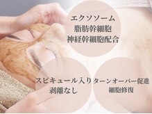 スカイ(sky)の雰囲気（１回で結果出し！赤み剥離ダウンタイムなし◎本気の肌質改善☆）