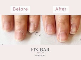 ネイルケアBefore→After