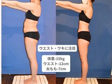 アンシャンテ 神戸元町店(Enchante)/痩身ダイエット　神戸元町三ノ宮