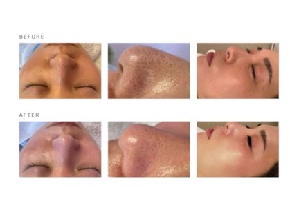 ルーラ(RULA)の写真