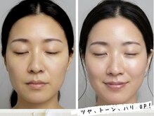 香嬉琉/Before/After ハーブテント