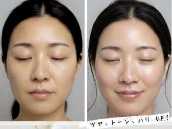 香嬉琉/Before/After ハーブテント