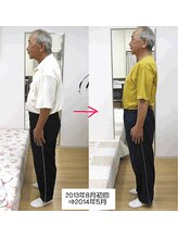 エスコート芦屋サロン/70代　男性　首痛　頭モヤモヤ