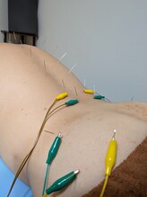 乃々鍼灸整体院 表参道/鍼灸×整体