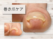 サンセリテ 用賀中町店(SINCERITE)の雰囲気(巻き爪ケアも行っておりますジェルネイルと一緒にできます)