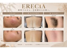 エレシア(ERECIA)の雰囲気（肌質改善｜WAX脱毛｜最新光脱毛｜メンズ脱毛｜即ツルツル実感）