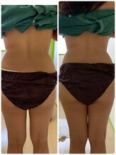 サロンドール(SalonDoll)/痩身