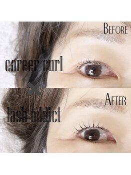 アンストン ボーテ(Instant de beaute)/【まつげのビフォーアフター】