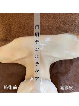 アール アンド ビューティーサロン(Ｒ＆ BeautySalon)/肩こり改善