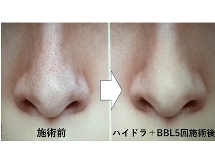 リュクス(LUXE)の写真
