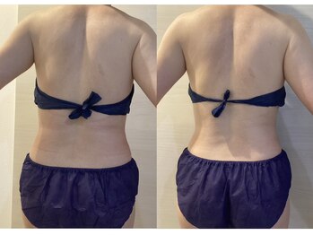 ホワイティアビシェル 浦和(Whitia Vishell)/北浦和痩身