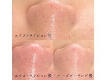 エマ(emma)