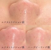 エマ(emma)