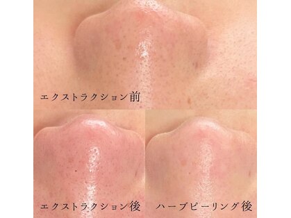 エマ(emma)の写真