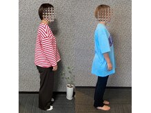 ビフォーアフター