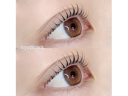 アイノワ 伏石駅前(eyenowa.)の写真