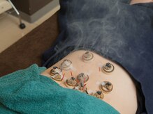 セントラルたなか鍼灸院 上社院/・鍼灸施術