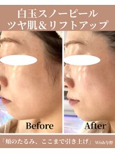 ウィッシュ 与野(Wish)/くすみ、一掃　艶めく小顔ライン