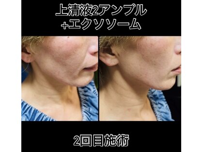 サロンモコ(Salon Moco)の写真