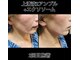 サロンモコ(Salon Moco)の写真