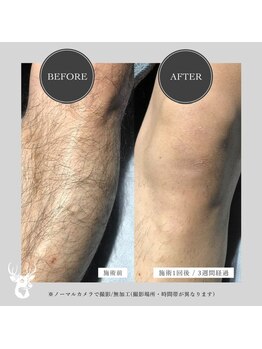 グランズ 芦屋(GLANZ)/Before→After