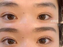 アノカプイル(ankpil)/【パリジェンヌラッシュリフト】