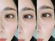 ビューティーベリッシモ(Beauty Bellissimo)の写真/【ご新規様☆LASH LIFTまつ毛パーマ+高濃度トリートメント付¥7150→¥5500】理想のモテ可愛eyeで女子力UP♪