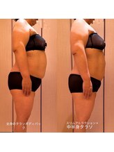 凪 横浜/タラソテピーの全体パックOR部分