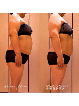 凪 横浜/タラソテピーの全体パックOR部分