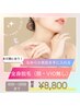 《Ladies脱毛》平日限定50%OFF！全身脱毛（顔・VIO無し）￥17,600→¥8,800 