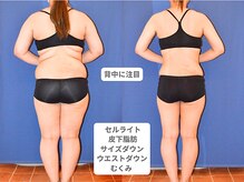 アンシャンテ 神戸元町店(Enchante)/痩身ダイエット　神戸元町三ノ宮