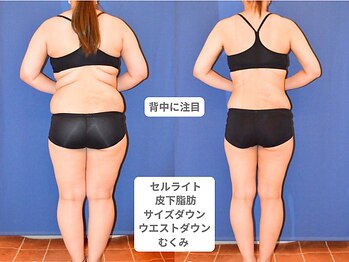 アンシャンテ 神戸元町店(Enchante)/痩身ダイエット　神戸元町三ノ宮