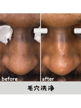 ルアナ 北谷店/ハーブピーリング 《沖縄/北谷》