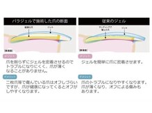 ライラ(RAIRA)/パラジェルとは？