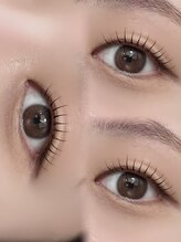 アロアイサロン(Alo's EYESALON)/札幌円山|丁寧なカウンセリング